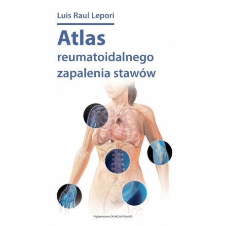 Atlas reumatoidalnego zapalenia stawów