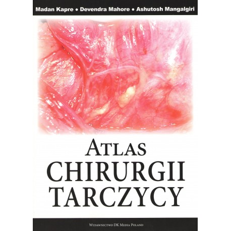 Atlas chirurgii tarczycy