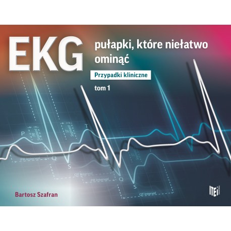 EKG pułapki, które niełatwo ominąć. Przypadki kliniczne Tom 1