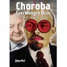 Choroba czerwonych oczu