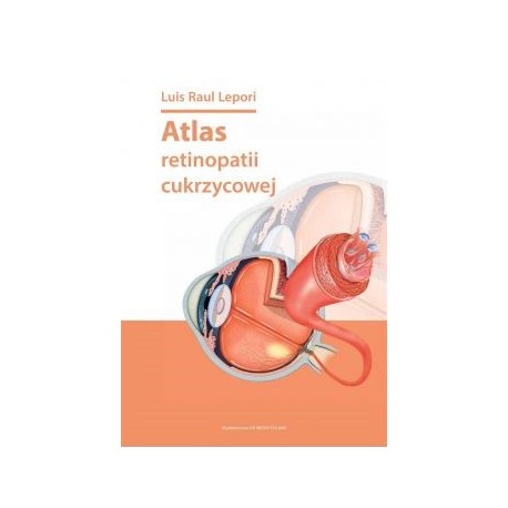 Atlas retinopatii cukrzycowej Luis Raul Lepori motyleksiazkowe.pl