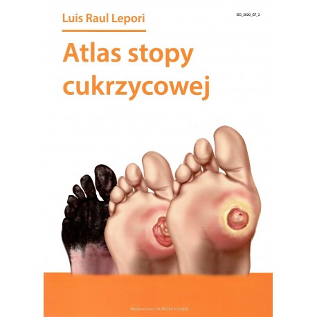 Atlas stopy cukrzycowej