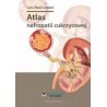 Atlas nefropatii cukrzycowej