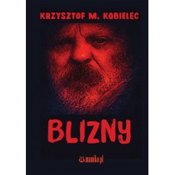 Blizny